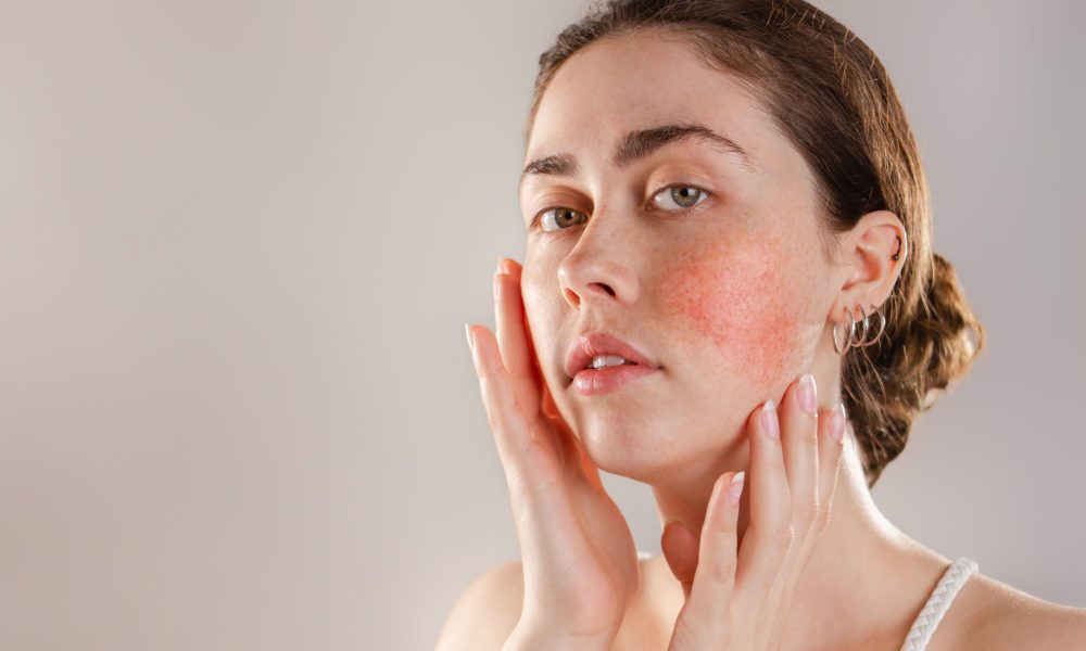 The face is the area where skin sensitivity is most observed, but this sensitivity can be seen in any part of the body.
